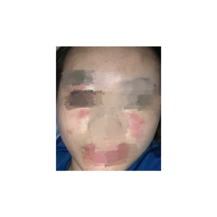 ローション/ピアベルピア/化粧水を使ったクチコミ(3枚目)