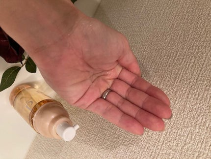 アクネケア ローション MB/d プログラム/化粧水を使ったクチコミ(1枚目)