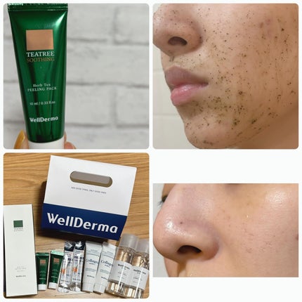 ティーツリーハーブピーリングパック/WellDerma/洗い流すパック・マスクを使ったクチコミ(2枚目)