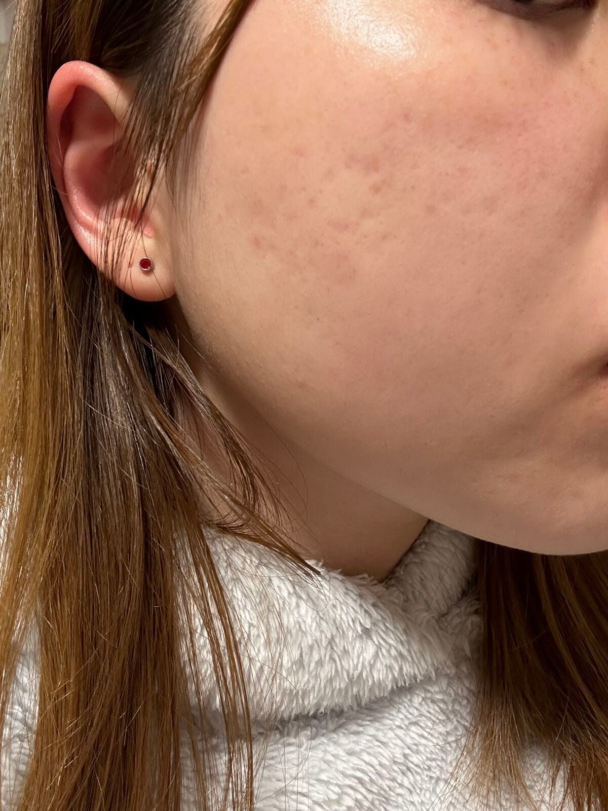 VC100エッセンスローション EX/ドクターシーラボⓇ/化粧水を使ったクチコミ(2枚目)