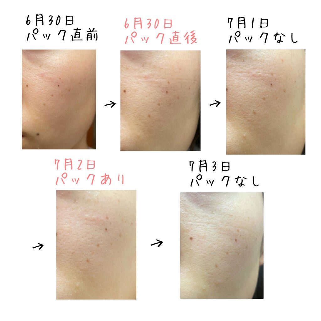 黒真珠マスク/我的美麗日記/シートマスク・パックを使ったクチコミ(2枚目)