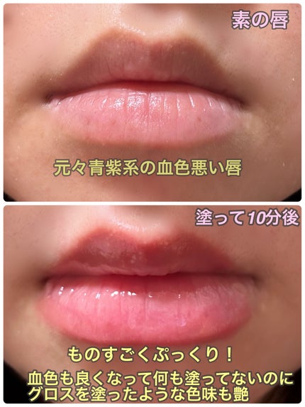 ボリュームリッププランパー/BANILA CO/リッププランパーを使ったクチコミ(6枚目)