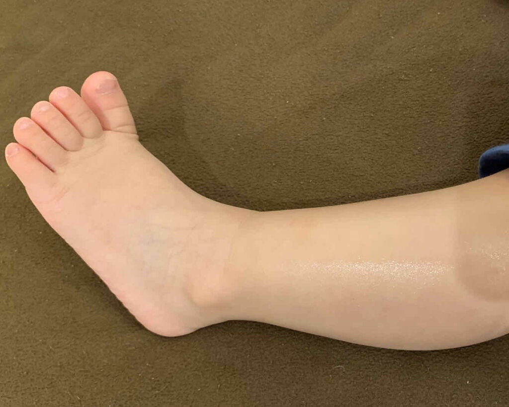 薬用保湿ミルクジェル/MEDIBABY/乳液を使ったクチコミ(3枚目)