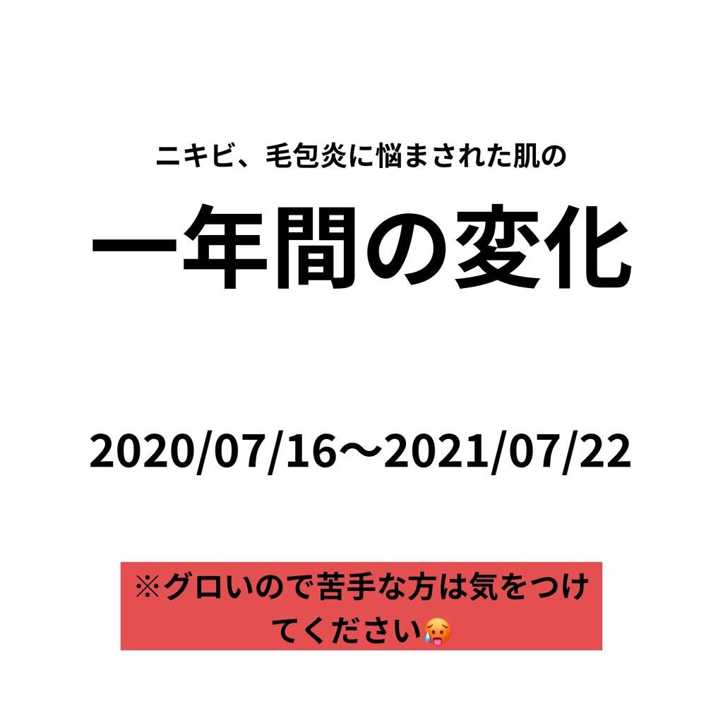 テラ・コートリル 軟膏(医薬品)/ジョンソン・エンド・ジョンソン/その他を使ったクチコミ(1枚目)