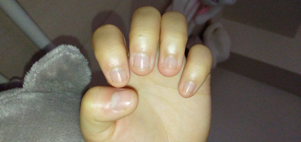 AC キューティクルオイル/AC MAKEUP/ネイルオイル・トリートメントを使ったクチコミ（3枚目）