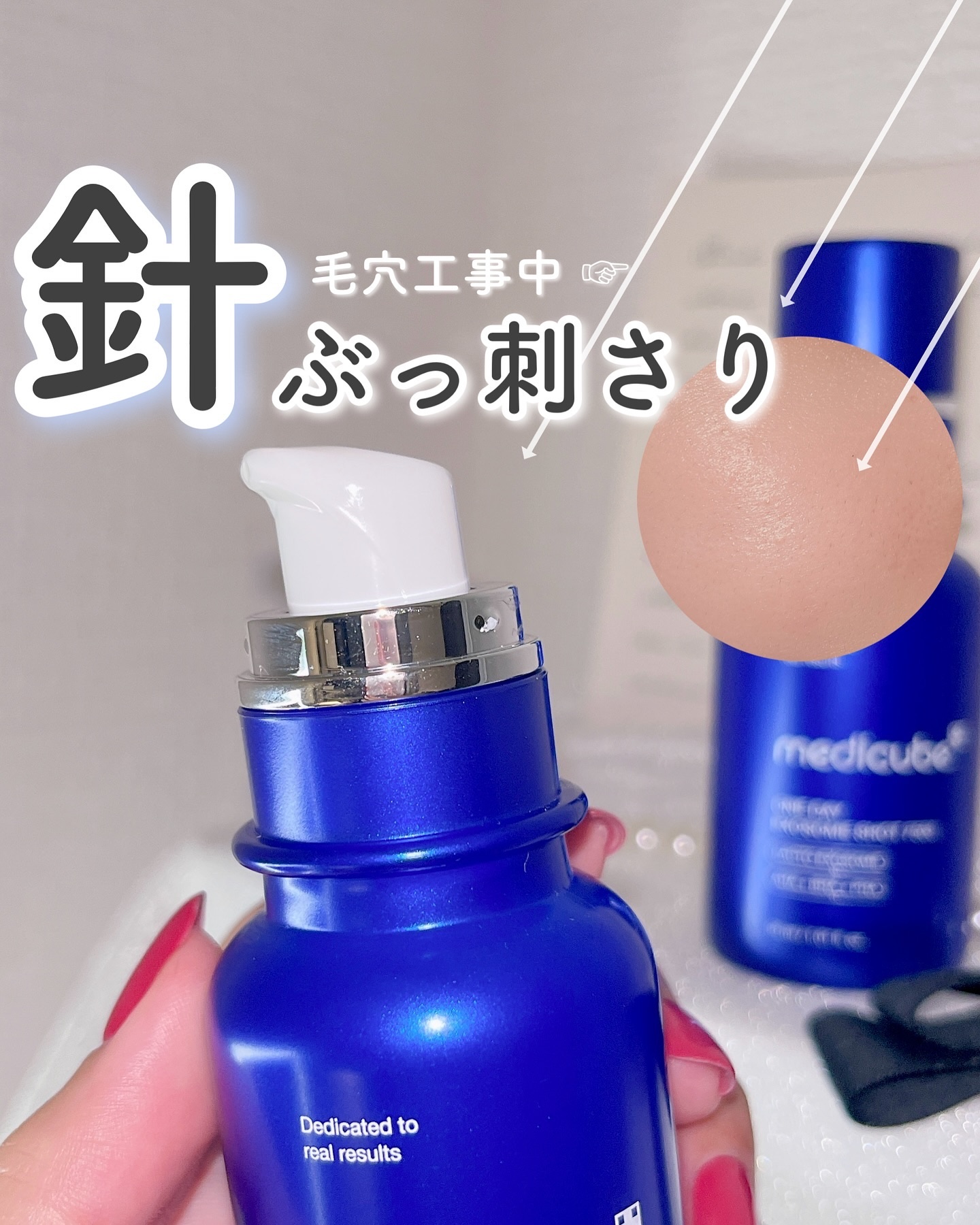 ゼロ1DAYエクソソームショット2000/MEDICUBE/美容液を使ったクチコミ（1枚目）