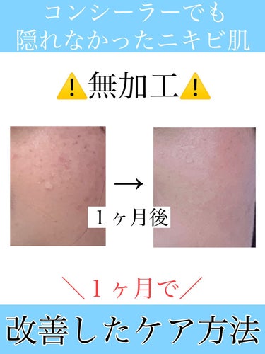 明色 美顔水 薬用化粧水 160ml(レトロデザインバージョン)/美顔/化粧水を使ったクチコミ（1枚目）