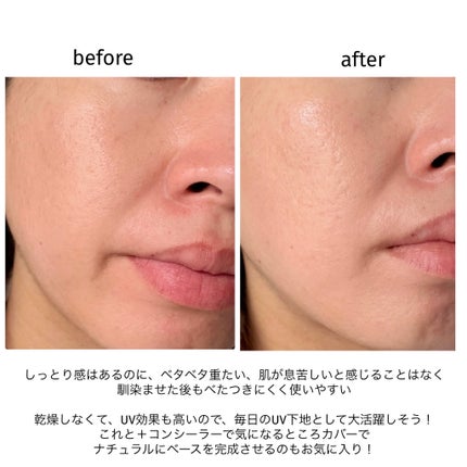 UVã€ã㢠XL ãããã¯ã·ã§ã³ããŒã³ã¢ãã ããŒãº+/ã© ããã·ã¥ ããŒ/æ¥çŒãæ¢ãã»UVã±ã¢ã䜿ã£ãã¯ãã³ãïŒ7æç®ïŒ