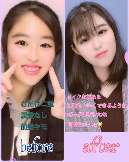 アイビューティー フィクサー WP/アストレア ヴィルゴ/二重まぶた用アイテムを使ったクチコミ(2枚目)