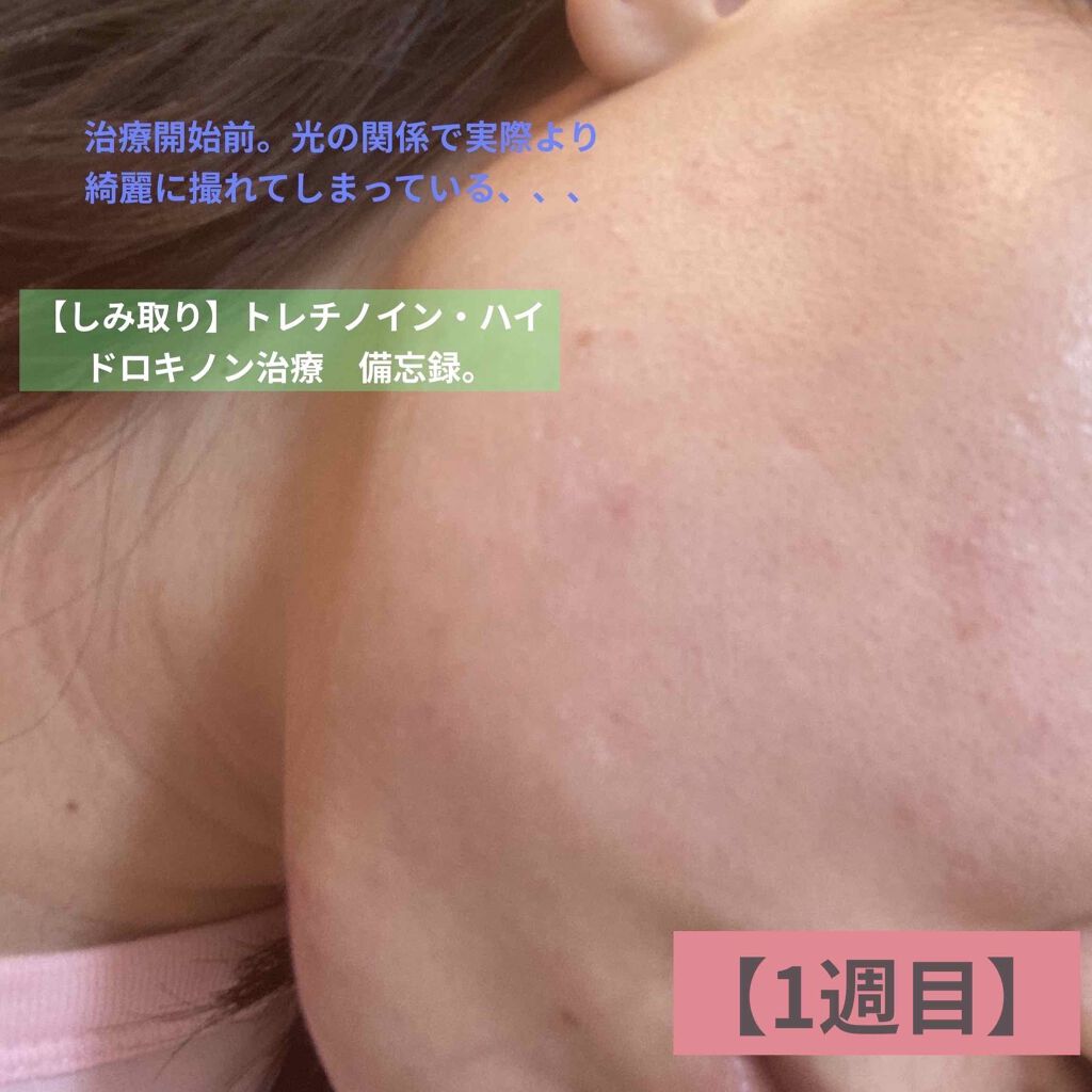 を使ったクチコミ（1枚目）