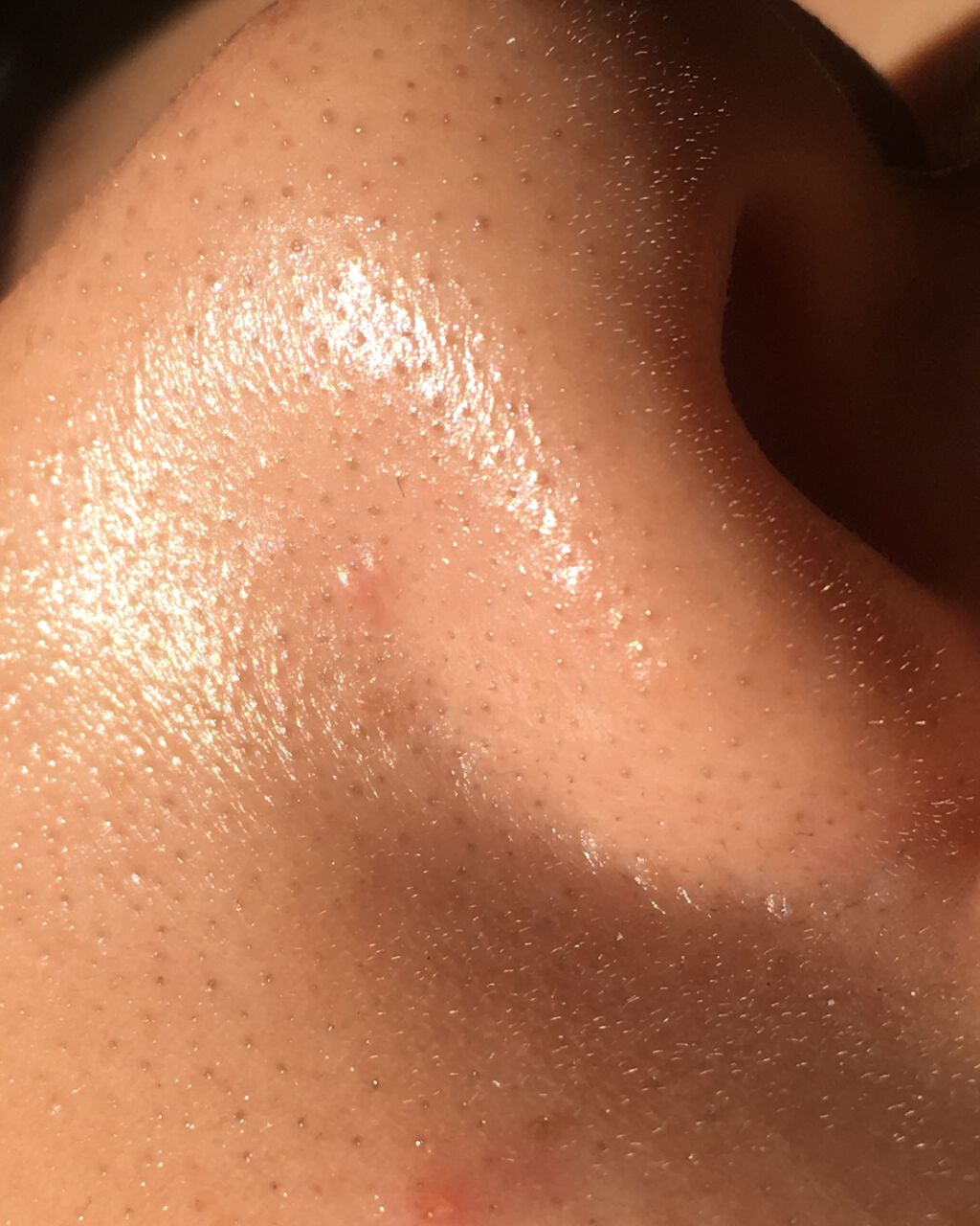 ð¥âðððððã¡ããð¥ on LIPS ã誰ãå©ããŠãã ããððçããã©ããªã¹ãã³ã±ã¢ããŠãŸããïŒ/çæŽ»..ãïŒ2æç®ïŒ