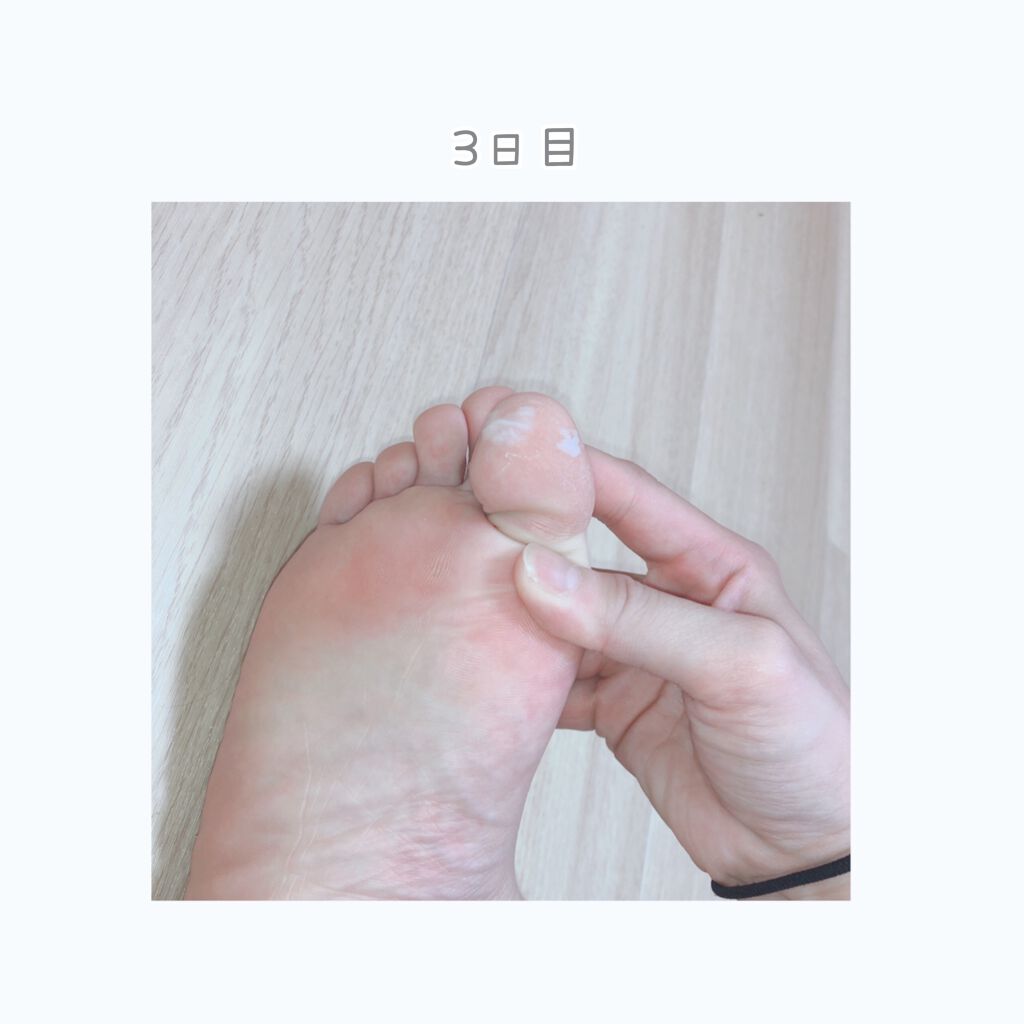 EVERYYOU 足裏角質パックAg ブラックミントの香り