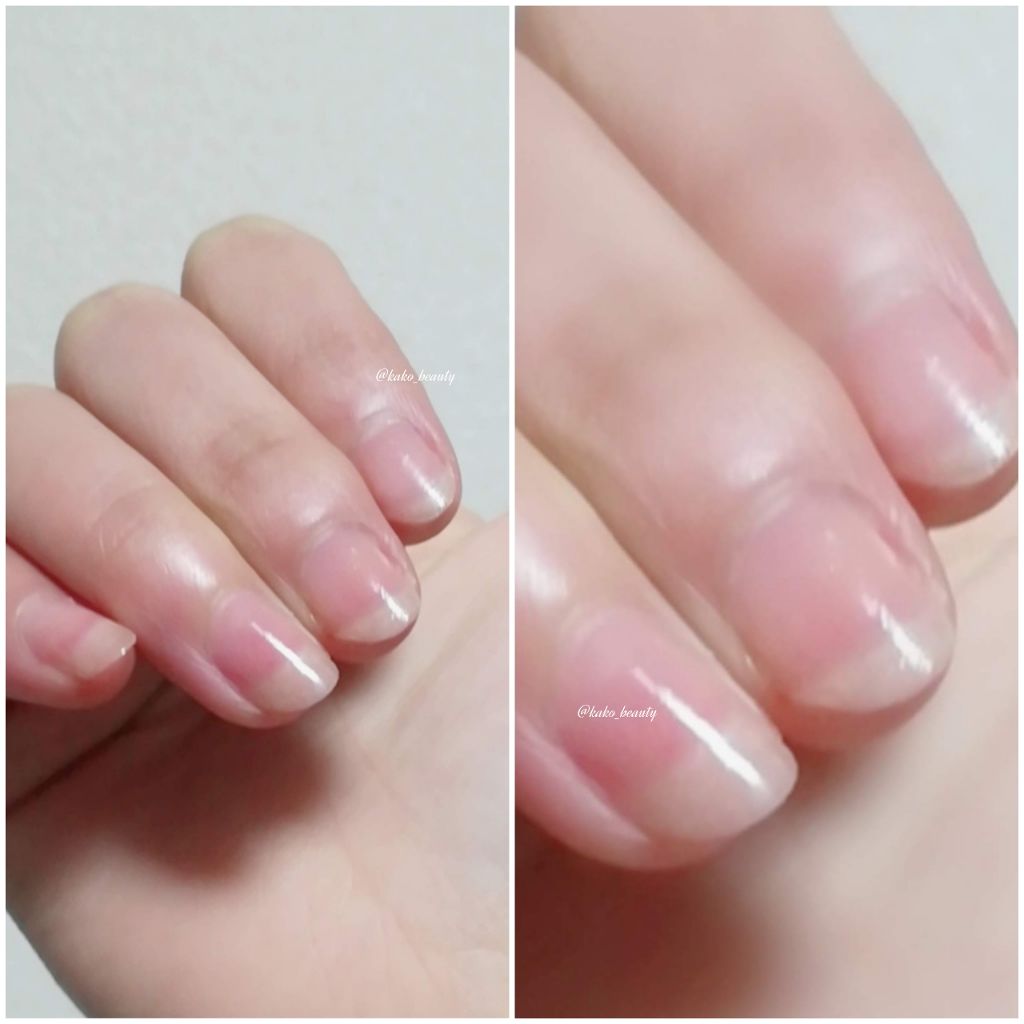 ネイルサポート ピンク/ネイルネイル/ネイルベースコートを使ったクチコミ（2枚目）