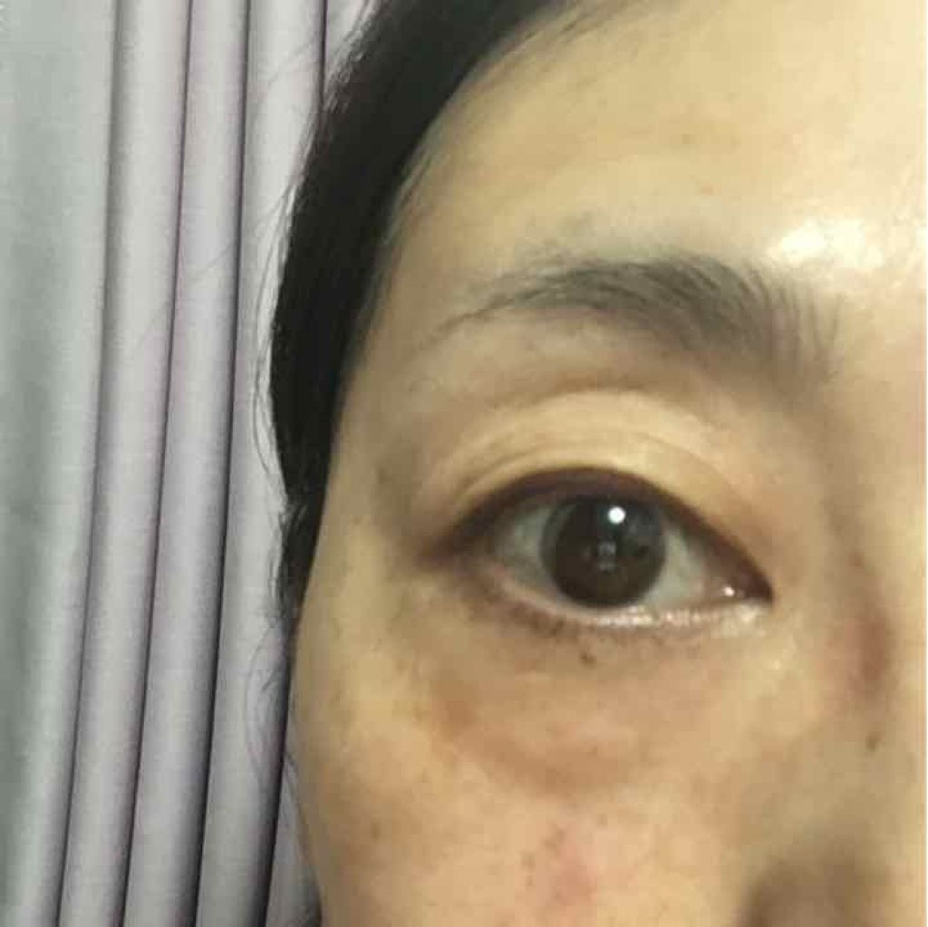 あきき on LIPS 「あまりの暑さにメイクを落としてしまいました!!!病院へは、すっ..」(1枚目)