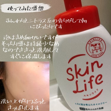 薬用泡のふんわり洗顔 160ml/スキンライフ/泡洗顔を使ったクチコミ（2枚目）