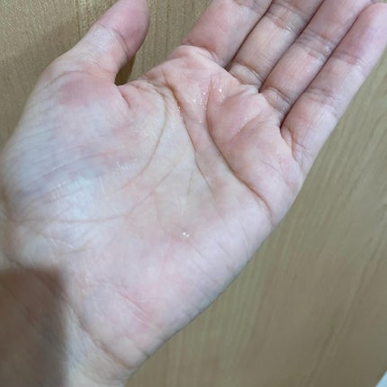 AZアゼライン酸10セラム/コスデバハ/美容液を使ったクチコミ(3枚目)