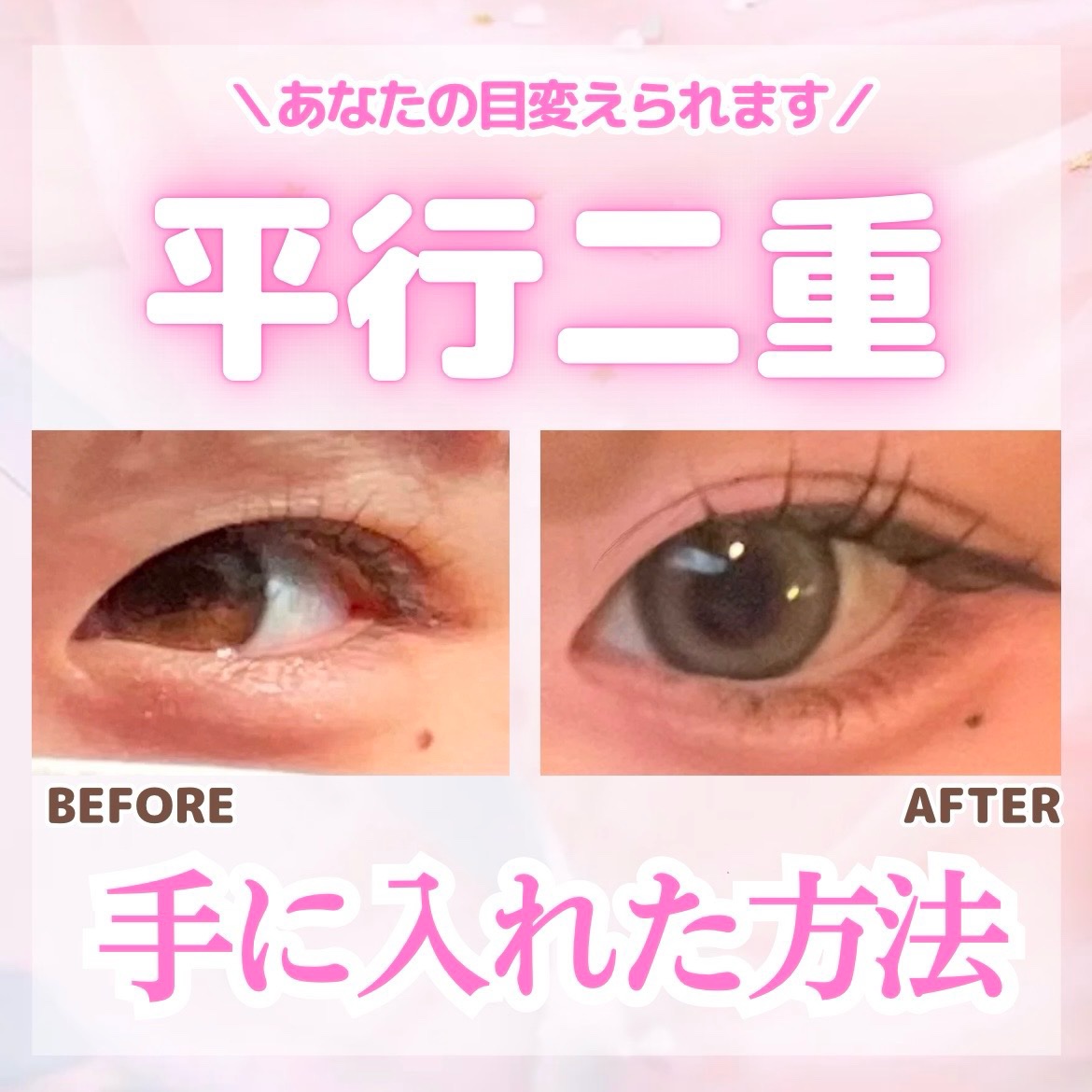 TWOOLダブルアイリッドハイブリットフィルム/SHOBIDO/二重まぶた用アイテムを使ったクチコミ（1枚目）