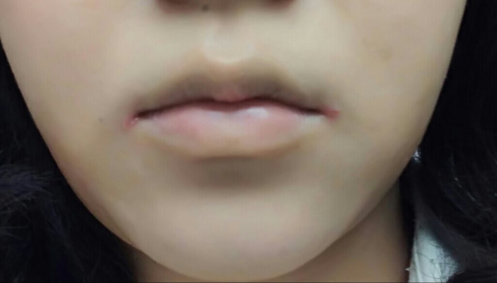 エテュセ リップエディション(グロス)/ettusais/リップグロスを使ったクチコミ（3枚目）