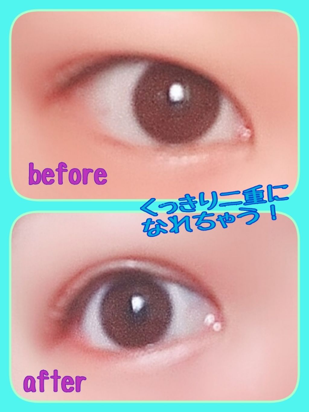 のび〜る アイテープ 両面テープタイプ/DAISO/二重まぶた用アイテムを使ったクチコミ（2枚目）