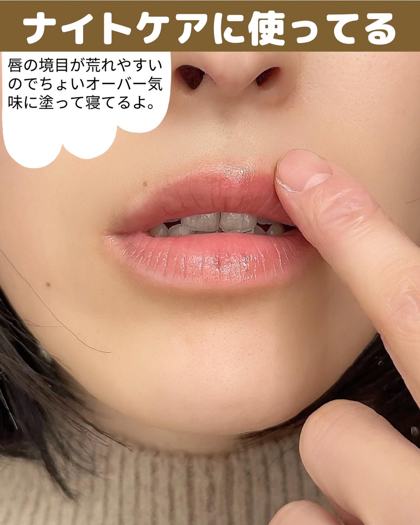 ヒビプロLP(医薬品)/メンソレータム/その他を使ったクチコミ(7枚目)