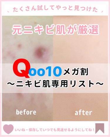 DR.WU マンデリック インテンシブ 18%セラムのクチコミ「【 Qoo10メガ割 】
長年ニキビに悩んだ私が厳選❤️‍🔥
沢山試して見つけたケアアイテムを.....」（1枚目）