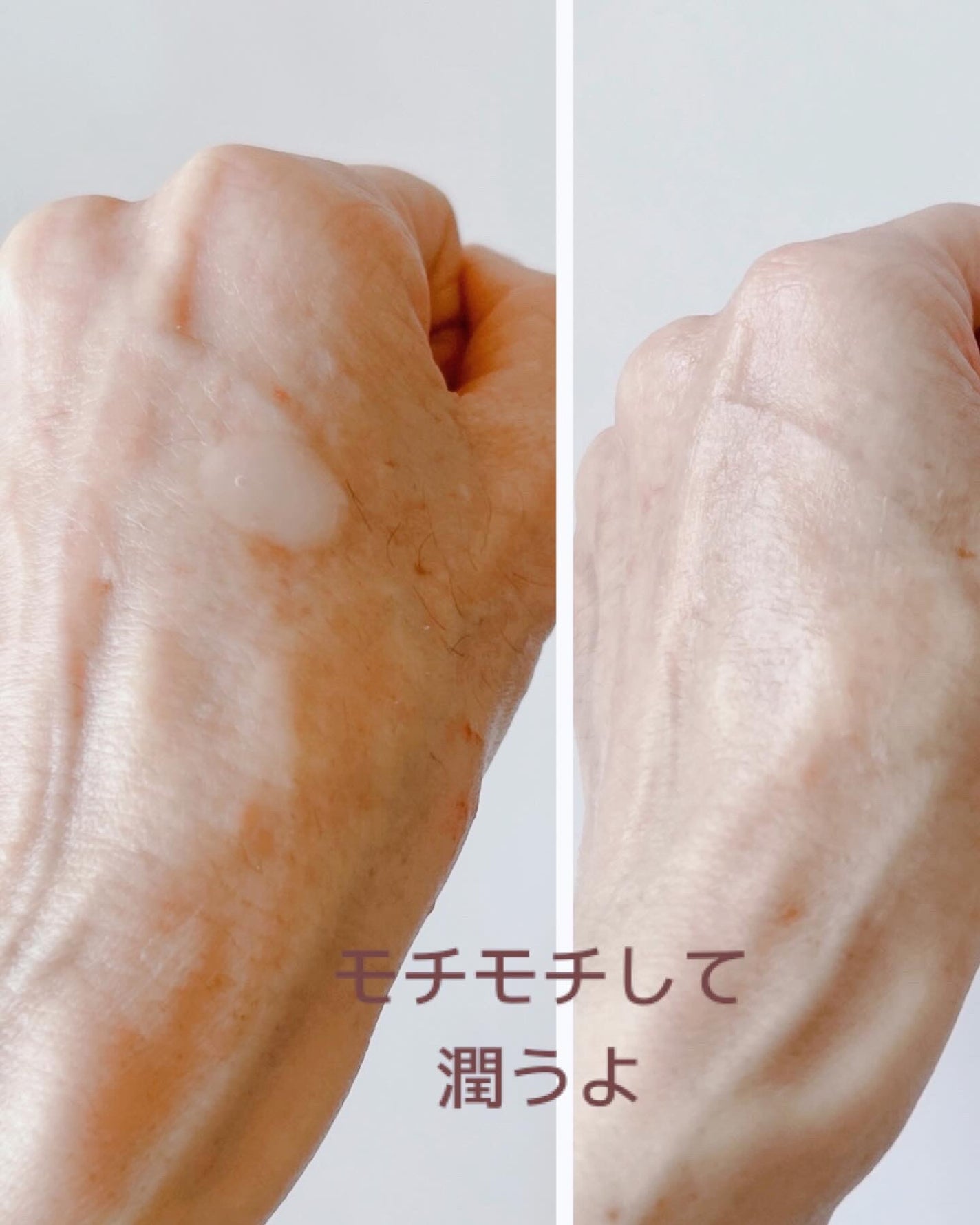 モアフルリフティングピールセラム/morefull /美容液を使ったクチコミ(3枚目)