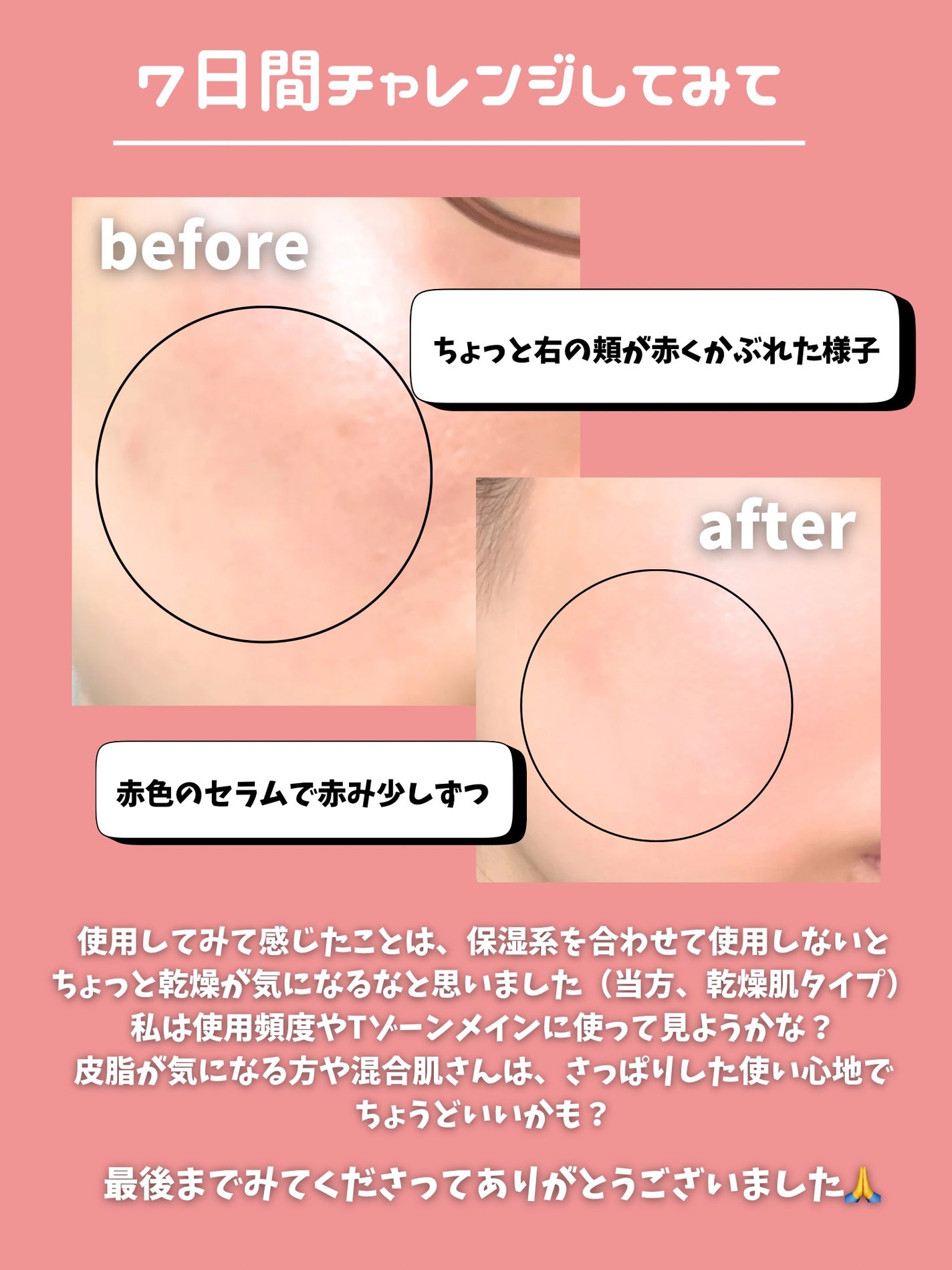 AZケア マスク/VT/シートマスク・パックを使ったクチコミ(6枚目)