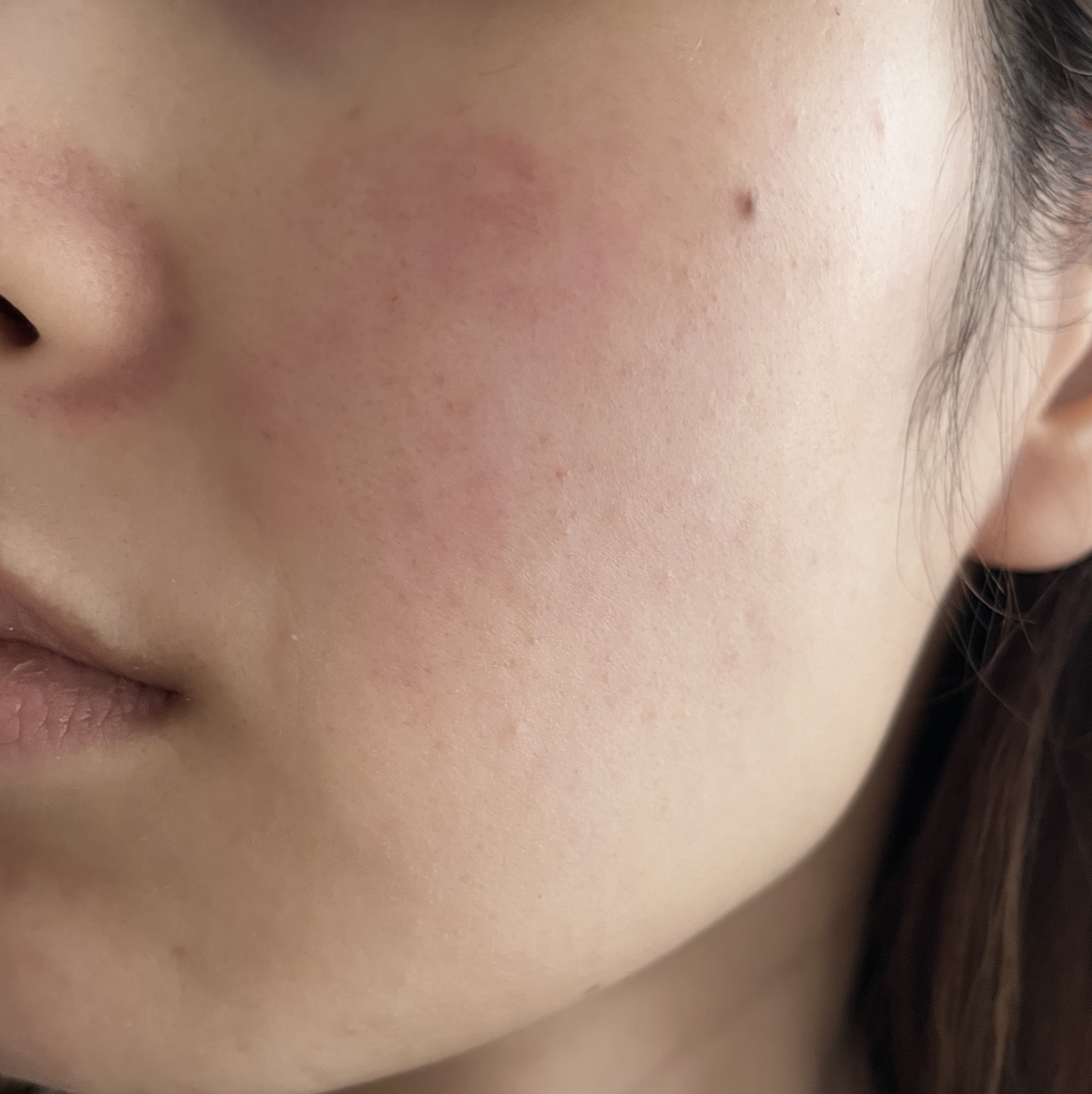 レシピオ モイストローションR/レシピオ/化粧水を使ったクチコミ（2枚目）