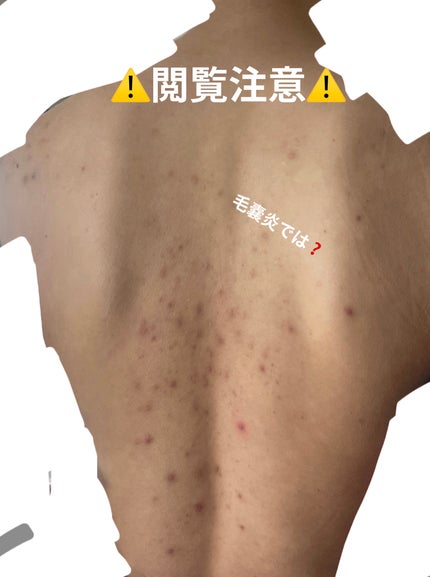 レチノールシカ リペアアンプル/innisfree/美容液を使ったクチコミ(2枚目)