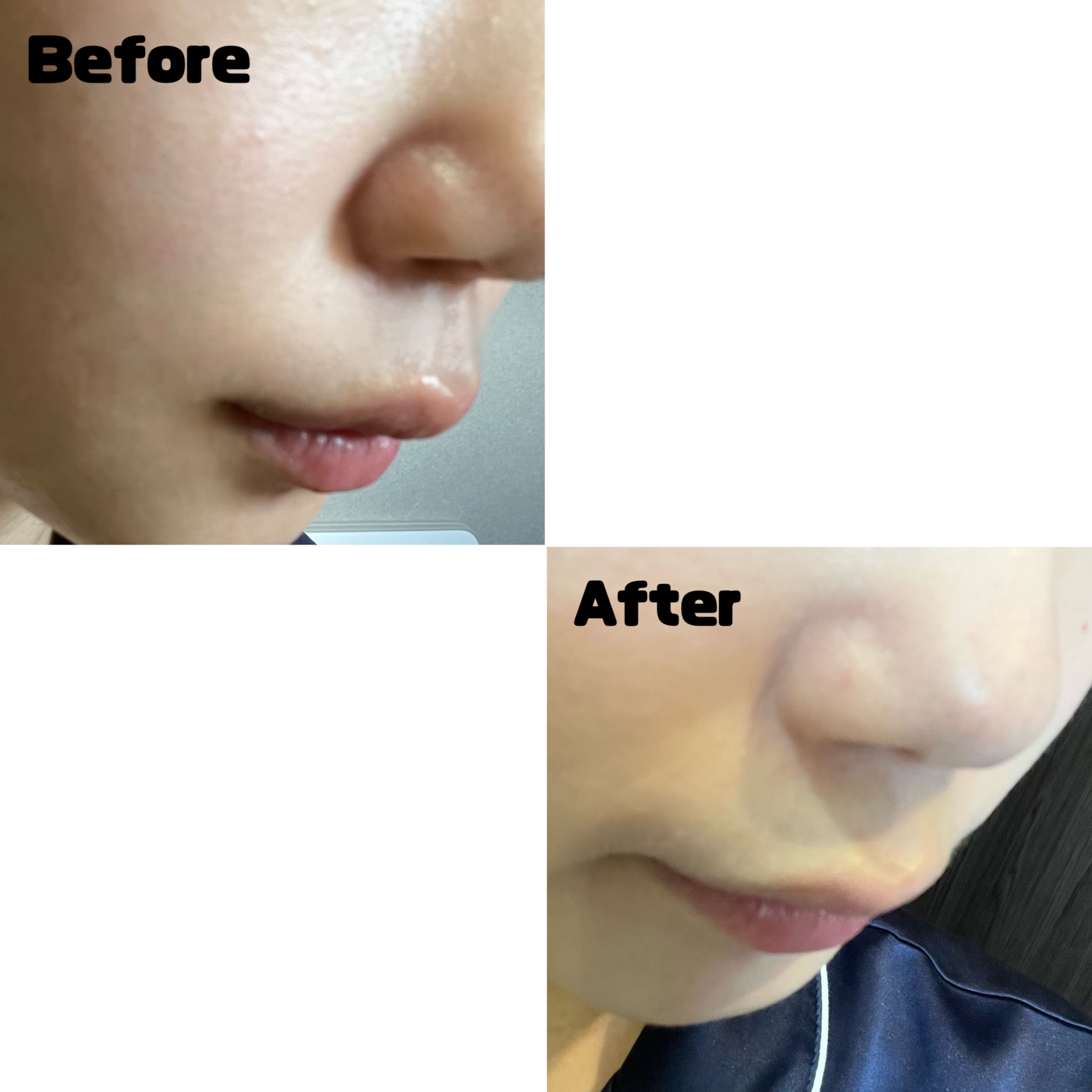 ルミネールスキップトーンアップクリーム/TFIT/化粧下地を使ったクチコミ（2枚目）