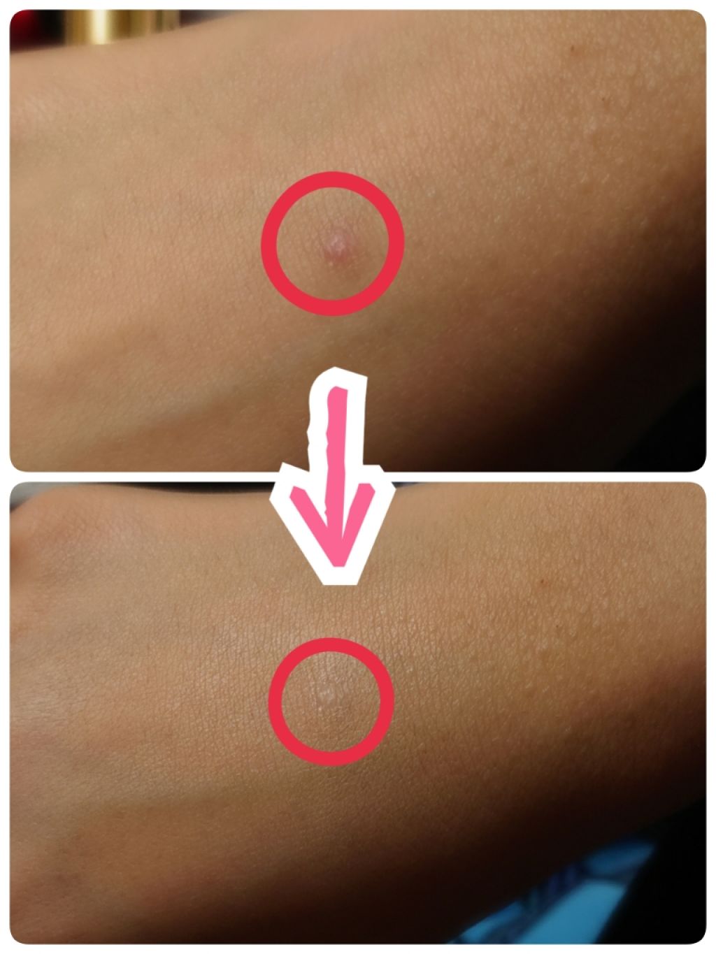 ラディアント タッチ ハイカバー/YVES SAINT LAURENT BEAUTE/リキッドコンシーラーを使ったクチコミ（3枚目）