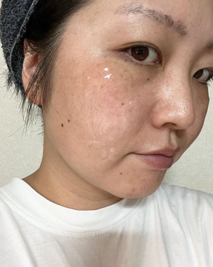 モイストボタニカル ジェルクレンジングR/unlabel/クレンジングジェルを使ったクチコミ(3枚目)