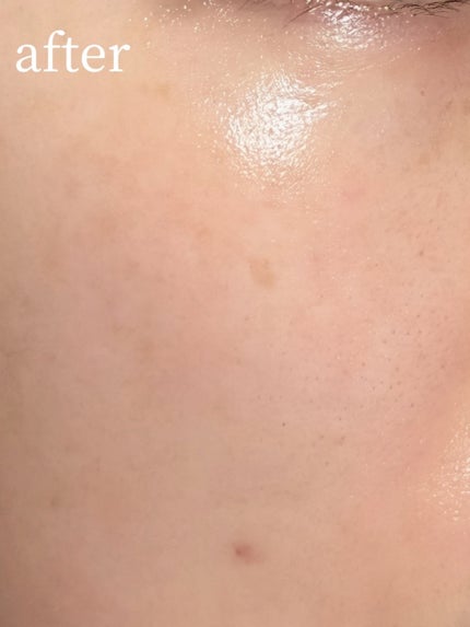 バイオコラーゲンリアルディープマスク/Biodance/シートマスク・パックを使ったクチコミ(5枚目)