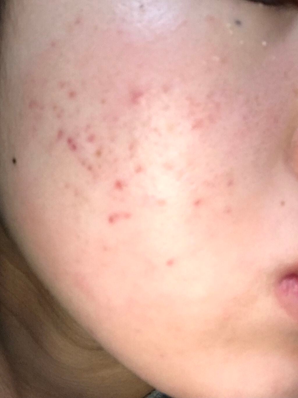 化粧水・敏感肌用・高保湿タイプ/無印良品/化粧水を使ったクチコミ(3枚目)