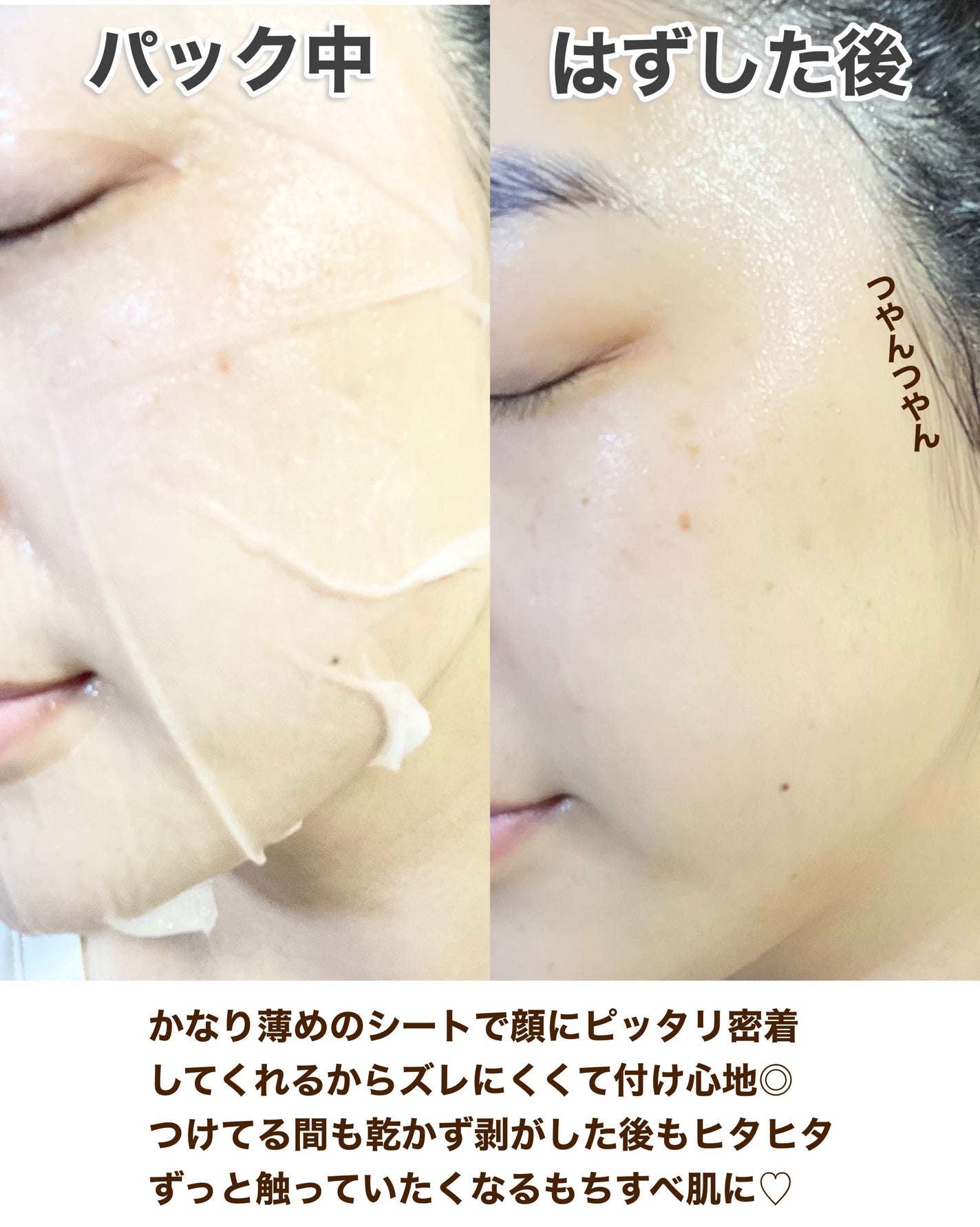 クリアエッセンスマスク/ピュレア/シートマスク・パックを使ったクチコミ(6枚目)