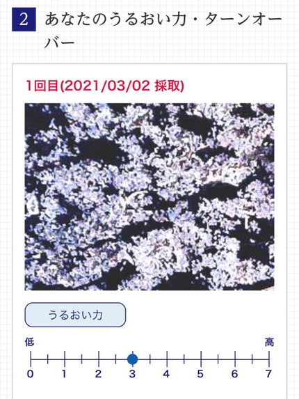 ライスフォース30日セット/ライスフォース/トライアルキットを使ったクチコミ(1枚目)