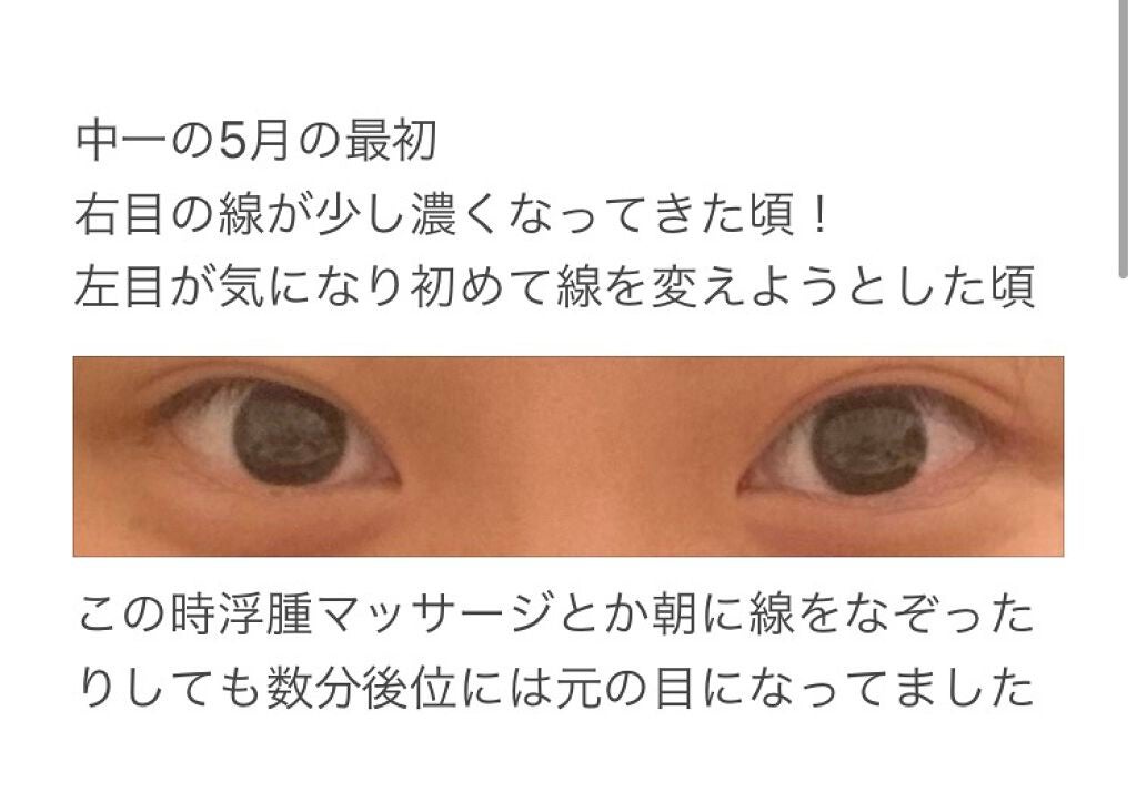 ヘアピン/LUCKY/ヘアアクセサリーを使ったクチコミ(6枚目)