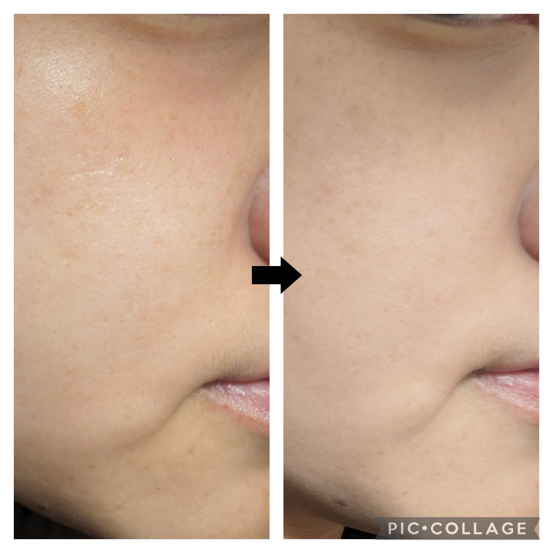 玉養桃花 ルースパウダー/花西子/ルースパウダーを使ったクチコミ（2枚目）