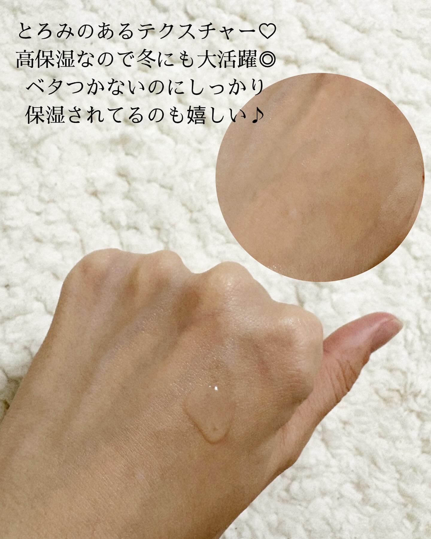 アクアヒアルロニックエッセンス/ロベクチン/化粧水を使ったクチコミ（2枚目）