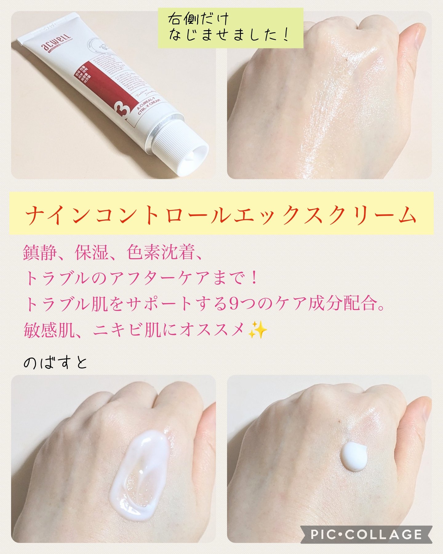 アキュリアルナインコントロールエックスクリーム/ACWELL/フェイスクリームを使ったクチコミ（2枚目）