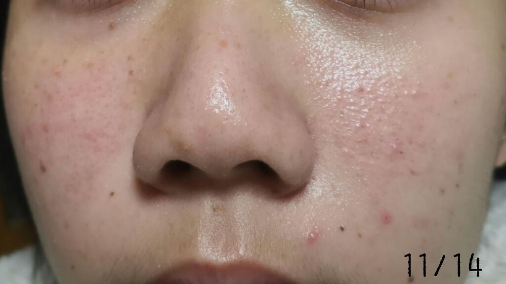 乳液・敏感肌用・高保湿タイプ/無印良品/乳液を使ったクチコミ(3枚目)