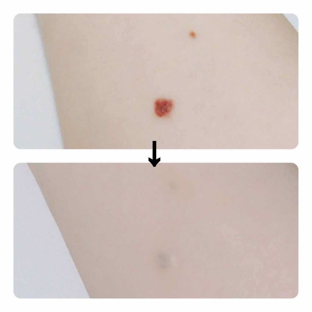 カバーパーフェクション チップコンシーラー/the SAEM/リキッドコンシーラーを使ったクチコミ(2枚目)