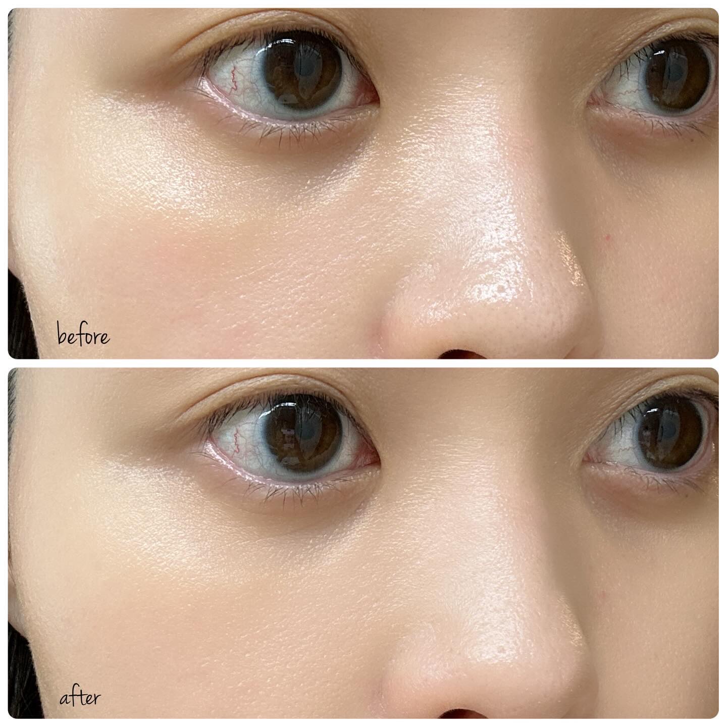 トワニー レイヤリングスキンリクイド/TWANY/リキッドファンデーションを使ったクチコミ（2枚目）