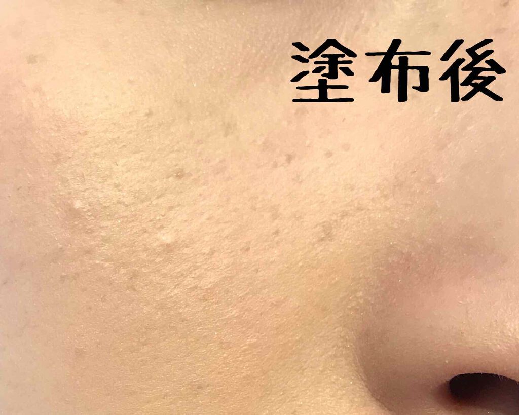 アルビオン パウダレスト/ALBION/パウダーファンデーションを使ったクチコミ（3枚目）