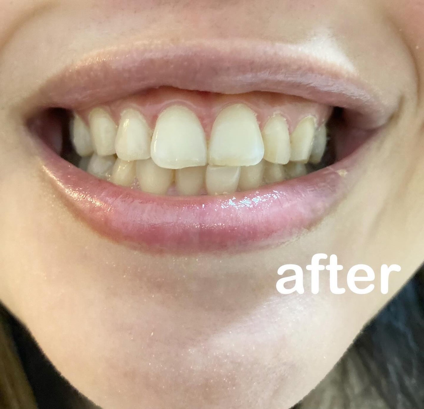 歯磨き堂 薬用ホワイトニングペースト プレミアム/歯磨き堂/歯磨き粉を使ったクチコミ(4枚目)