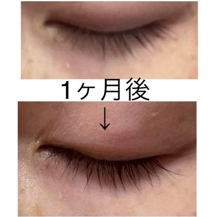 ラッシュアディクト アイラッシュコンディショニングセラム/soaddicted/まつげ美容液を使ったクチコミ(2枚目)