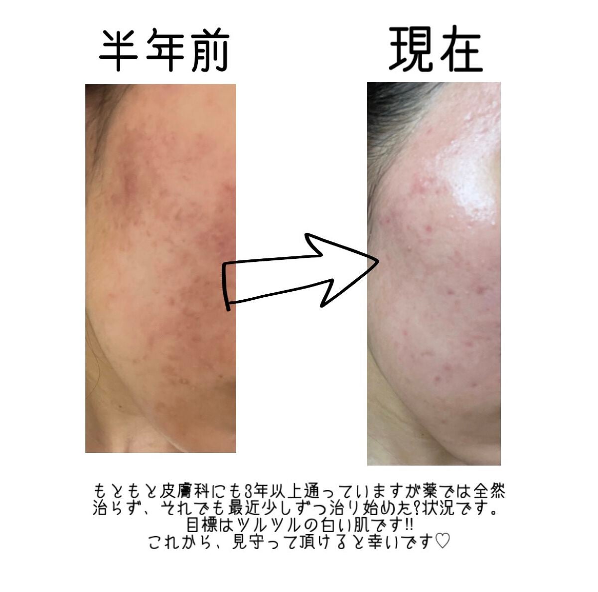 デュオ ザ クレンジングバーム/DUO/クレンジングバームを使ったクチコミ(2枚目)