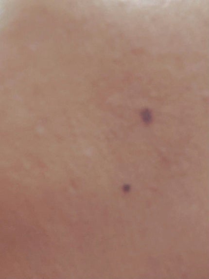 薬用リップケア モイスト <医薬部外品>/アベンヌ/リップクリームを使ったクチコミ(8枚目)