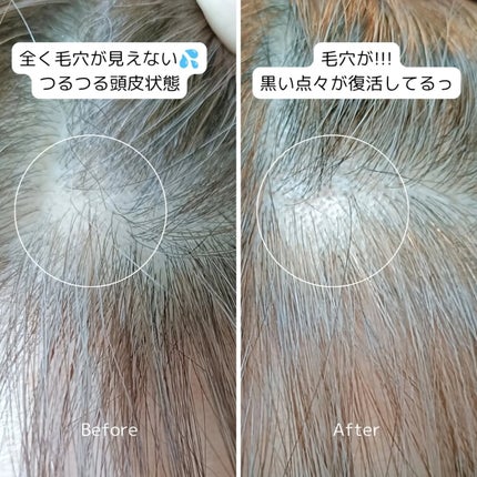 koyami❥フォロバ100 on LIPS 「髪の悩みにアプローチしてくれる"バイオグロウ・ナインショット"..」(4枚目)