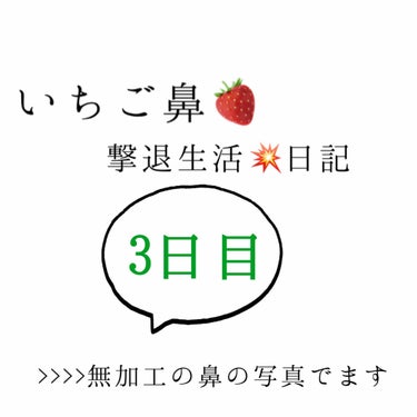 いちご鼻撃退生活3日目！

鼻ニキビが出来たのでしばらくは、洗顔だけにしてました！

治ったので今日からまた再会します〜
なんか、減ってるのか分からない笑


#いちご鼻 #毛穴ケア #撃退日記